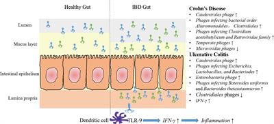 Roles of Gut Bacteriophages in the Pathogenesis and Treatment of Inflammatory Bowel Disease